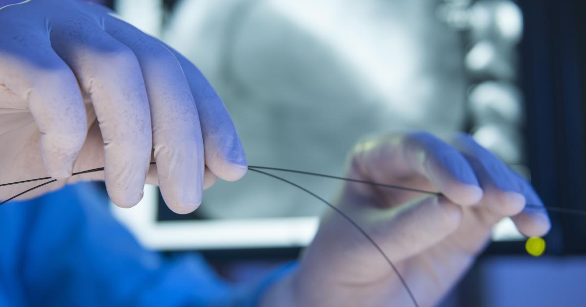 Angioplastie: Warum sie gemacht wird, wie man sich vorbereitet, was zu ...