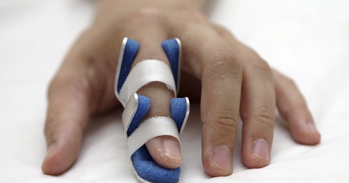 Gebrochener Finger Symptome, Ursachen, Behandlungen
