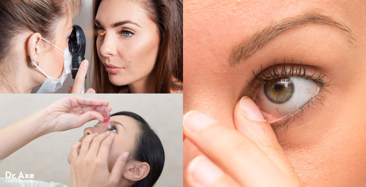 Hornhautabschürfung 6 natürliche Wege zur Linderung eines verkratzten