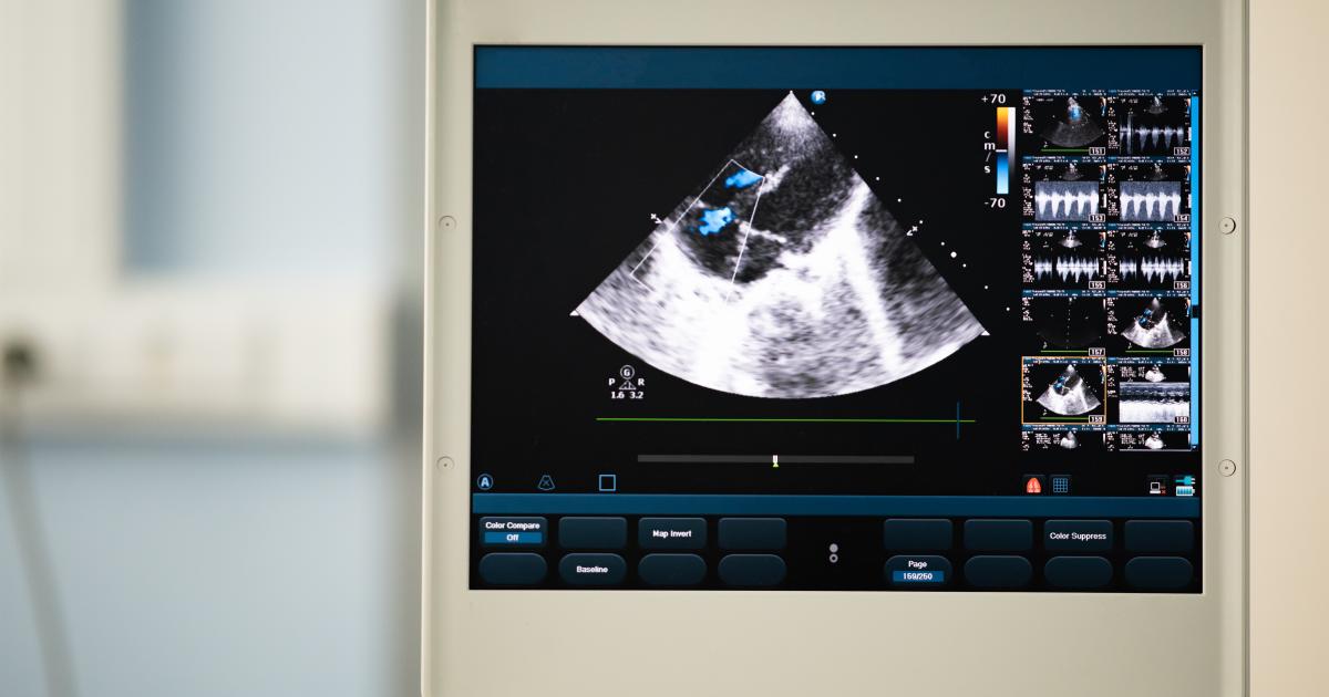 Doppler-Ultraschall-Test: Diagnose, Ergebnisse & Verfahrensübersicht ...