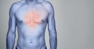 Ösophagitis Symptome, Ursachen, Behandlungen